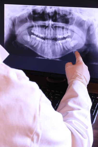 Best Emergency Gum Treatment in Evansville, IN
